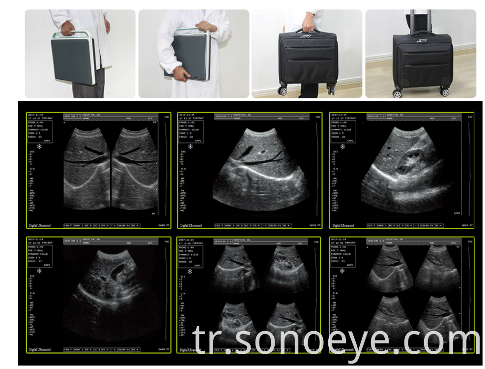 Portable Ultrasound Labtop Type